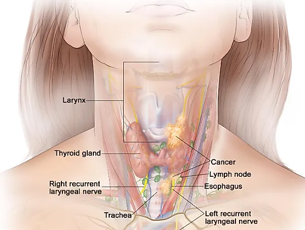 Заболевания щитовидной железы