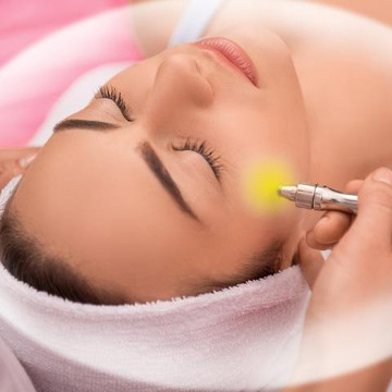 Омоложение лица элос